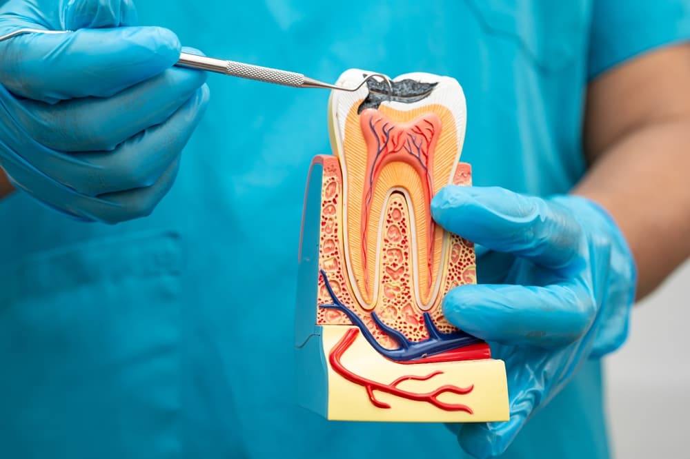 Root Canal Treatment