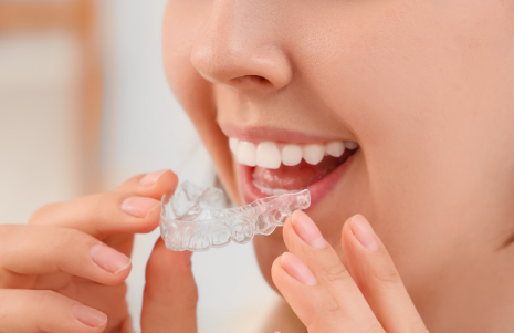Teeth Grinding and Night Guards: How to Protect Your Smile