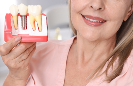 Rediscover Your Smile with Wolverhampton’s Leading Dental Implant Experts